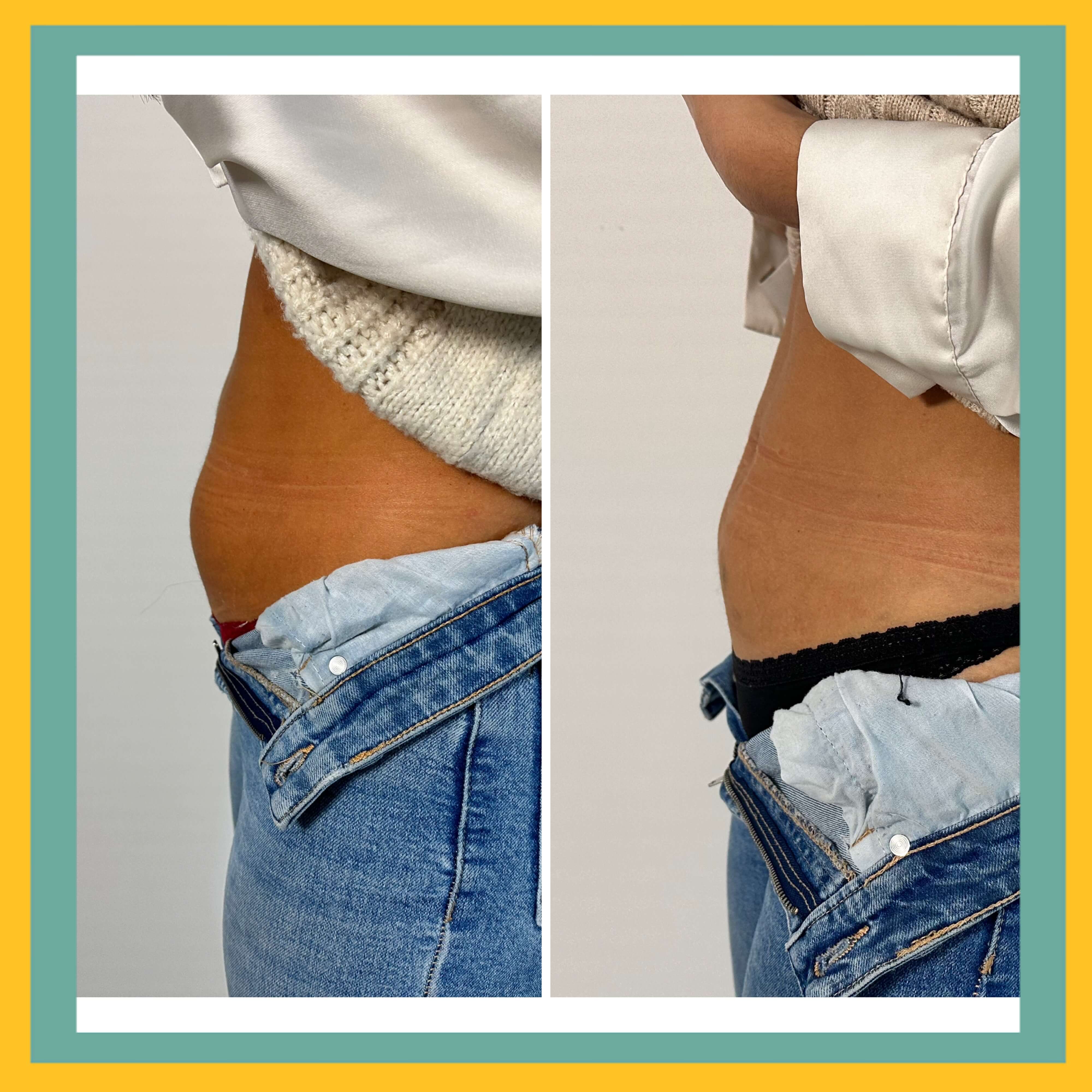 Before and After Lemon bottle